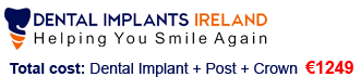 Dental Implants Ireland - Logo